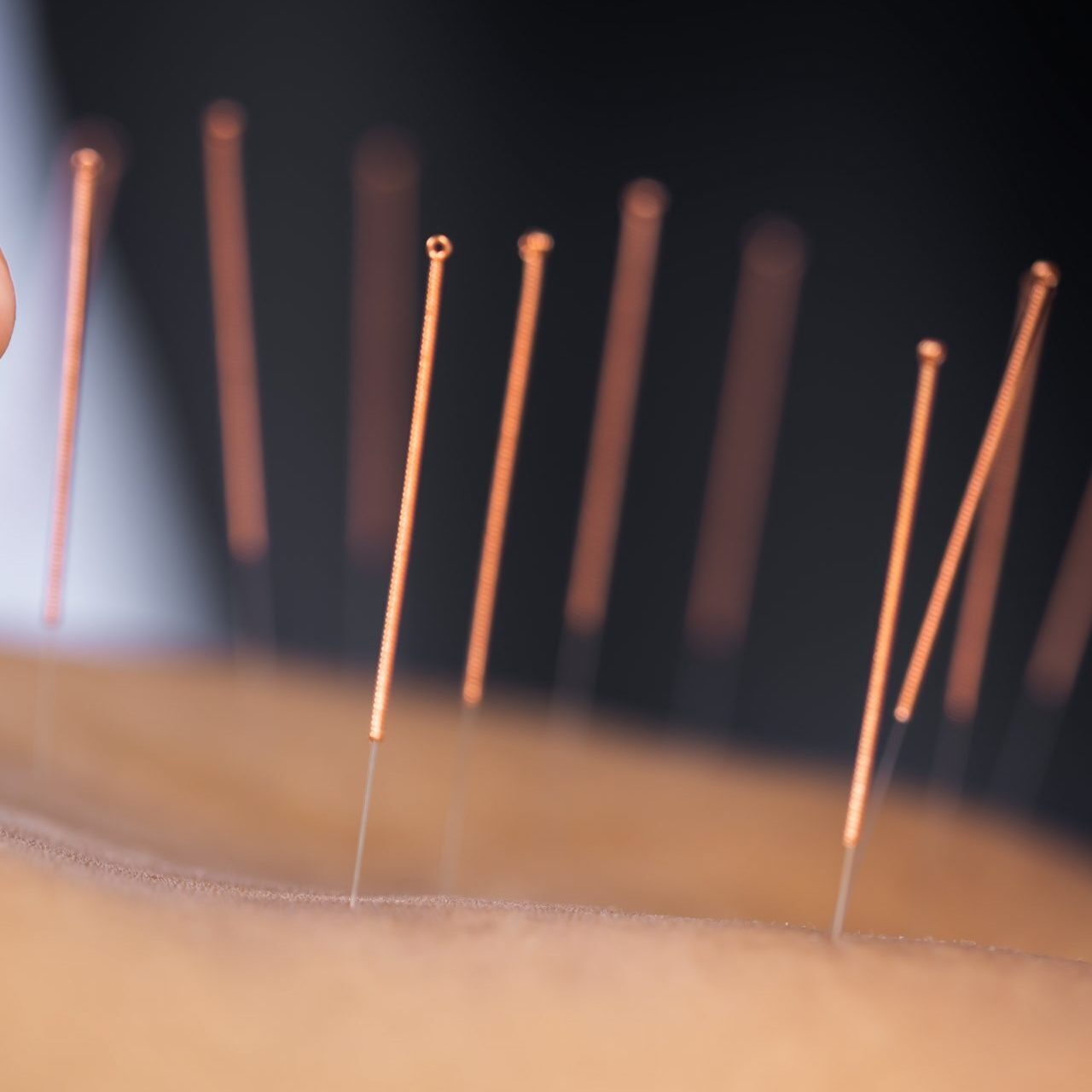 Acupuncture-Bio-restoration-scaled-2560x1280